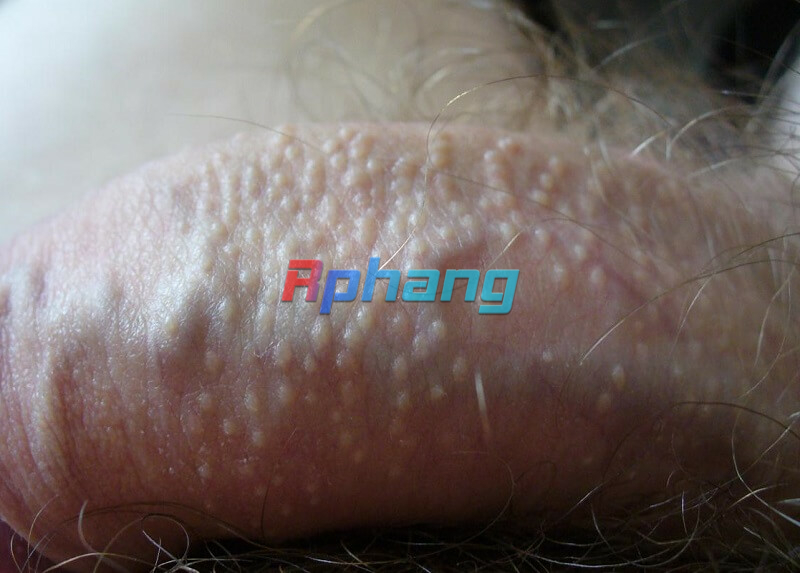 mun-duong-vat-8.jpg