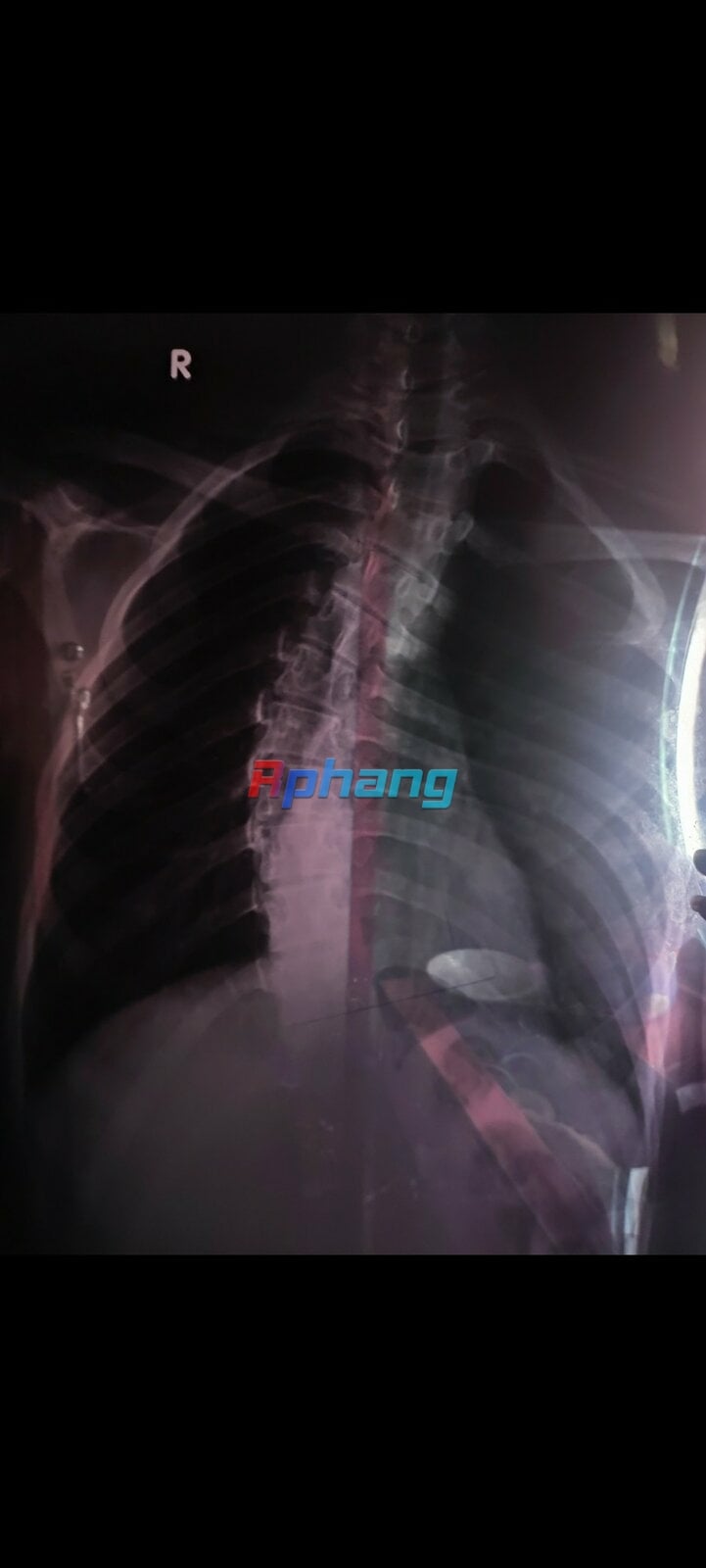 z4849790988915_8d7d6ac0dfdedd5dbe6f9c3624756c53.jpg