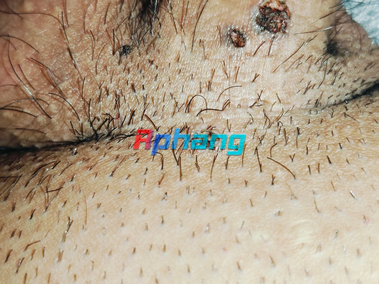 1000001842.jpg