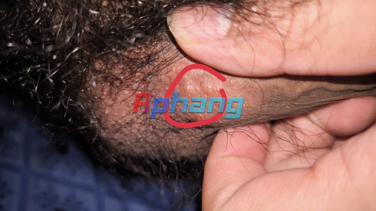 1000006279.jpg