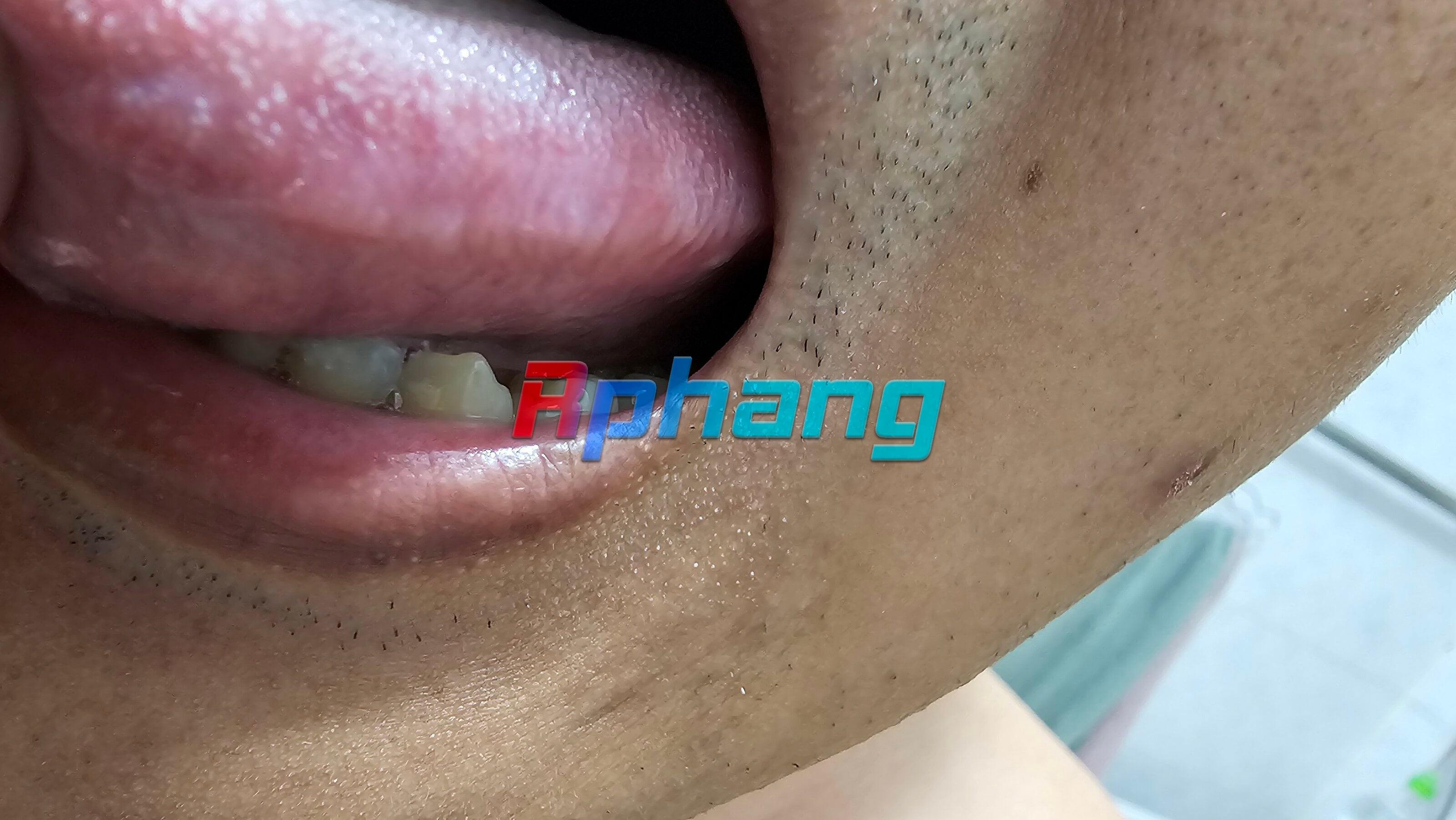1000013926.jpg