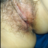 Rphang_001